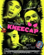 Kneecap